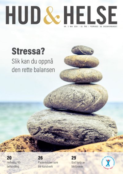 Bilde: Hvordan takler vi stress?