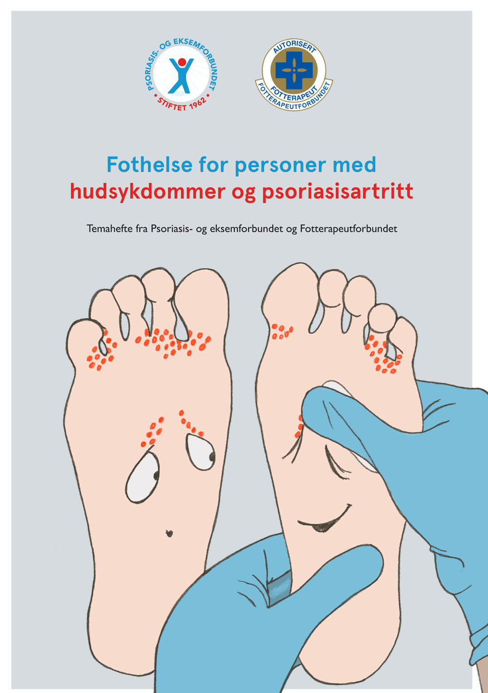 Fothelse for personer med hudsykdommer og psoriasisartritt