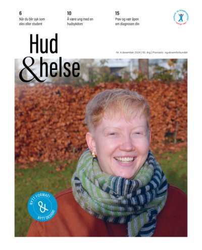 Bilde: Hud & Helse er redesignet